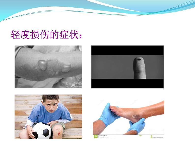 3.2 轻度损伤的自我处理 (课件) 体育与健康五年级上册 人教版 (12张PPT)第4页