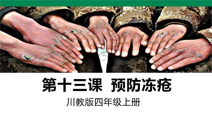 【川教版】《生命 生態(tài) 安全》四上第13課《預防凍瘡》課件第1頁