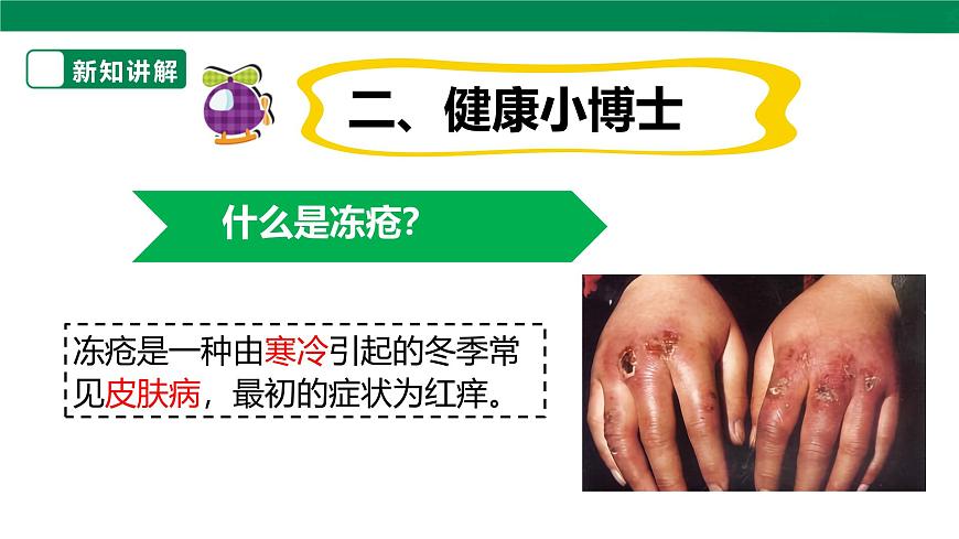 【川教版】《生命 生態(tài) 安全》四上第13課《預防凍瘡》課件第7頁