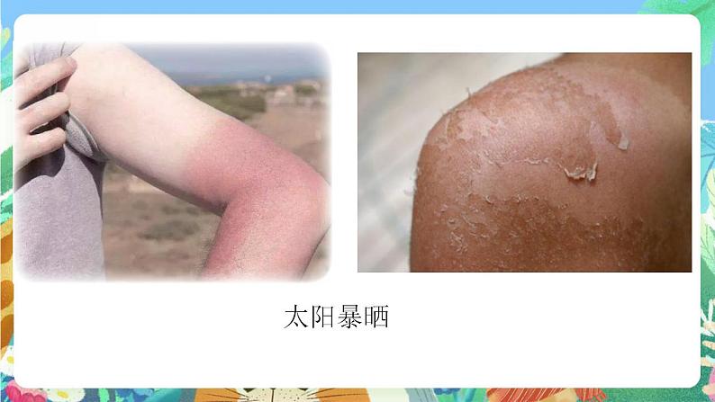 青岛版科学六年级下册1.5《触觉》课件+教案+练习(含答案)+素材08