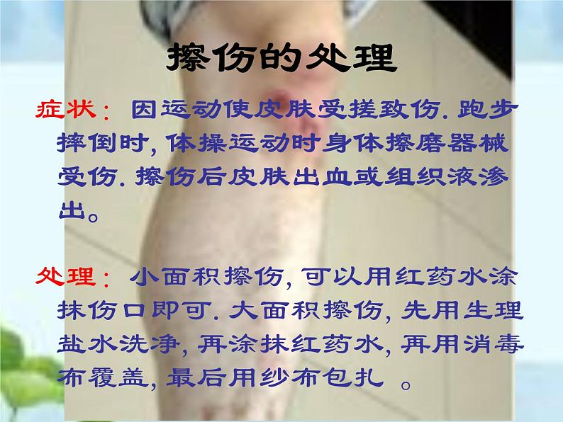人教版八年级体育全一册:1.2常见运动损伤的预防和紧急处理-课件(8)第7页