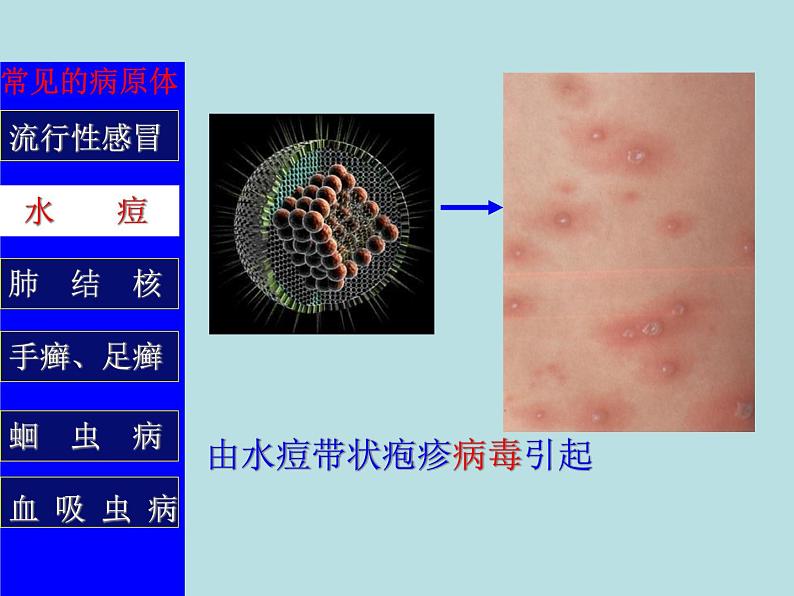 (新人教版)八年级下册第一章传染病和免疫第一节传染病及其预防教学课件(生物)第8页