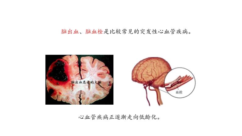 心脏和血管的保护PPT课件免费下载07