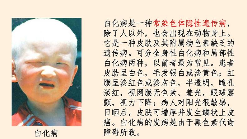 20.6 遗传病和人类健康 课件 初中生物北师大版 八年级上册(2021年)第7页