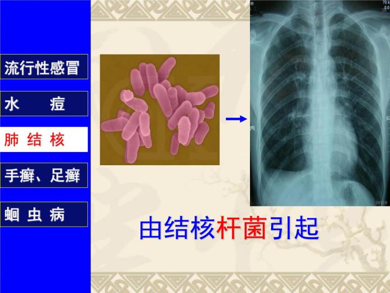 上海版八年级上册生物  3.2.1 常见传染病及其预防 课件   (共37张PPT)07