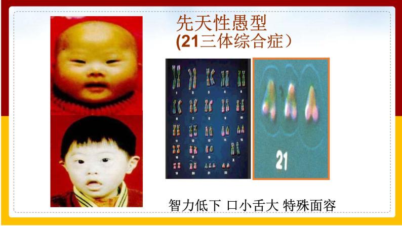 第8单元 生物的生殖、发育与遗传 第22章 生物的遗传和变异 第4节 遗传病和优生优育课件PPT07
