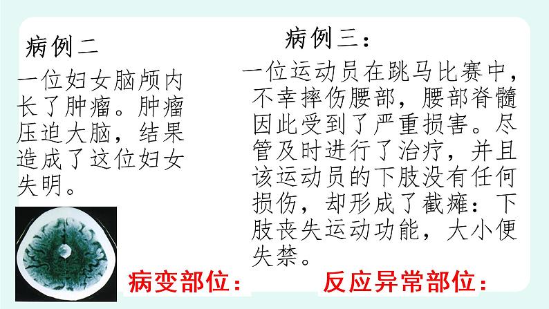 12.1神经系统与神经调节(1)-课件第5页