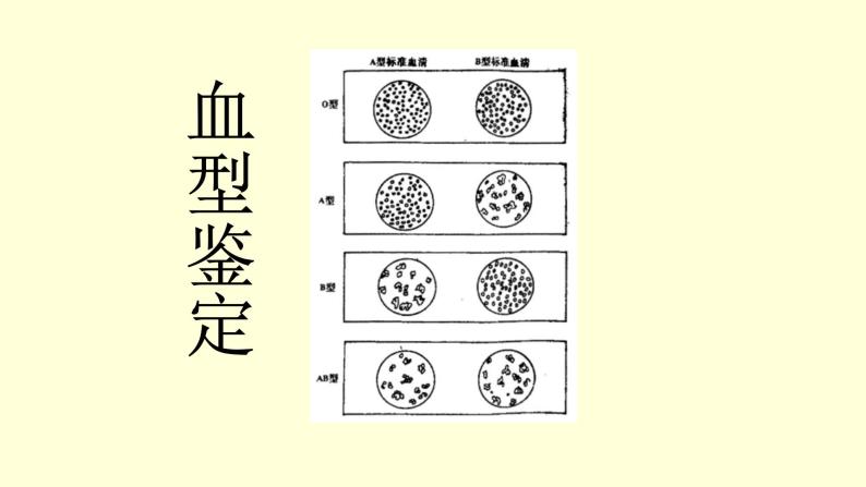 人教版七年级生物下册----4.4.4 输血与血型  课件06