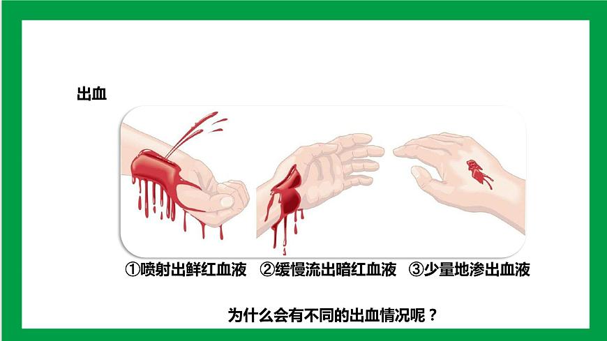4.4.2血流的管道——血管 課件第3頁(yè)