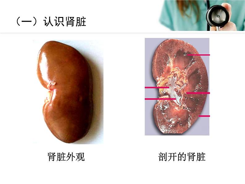 《人体内废物的排出》课件第5页