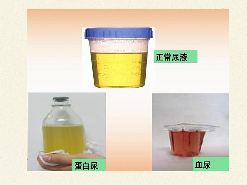 北师大版生物七年级下册 第11章 第1节 人体产生的代谢废物(1)(课件)第6页