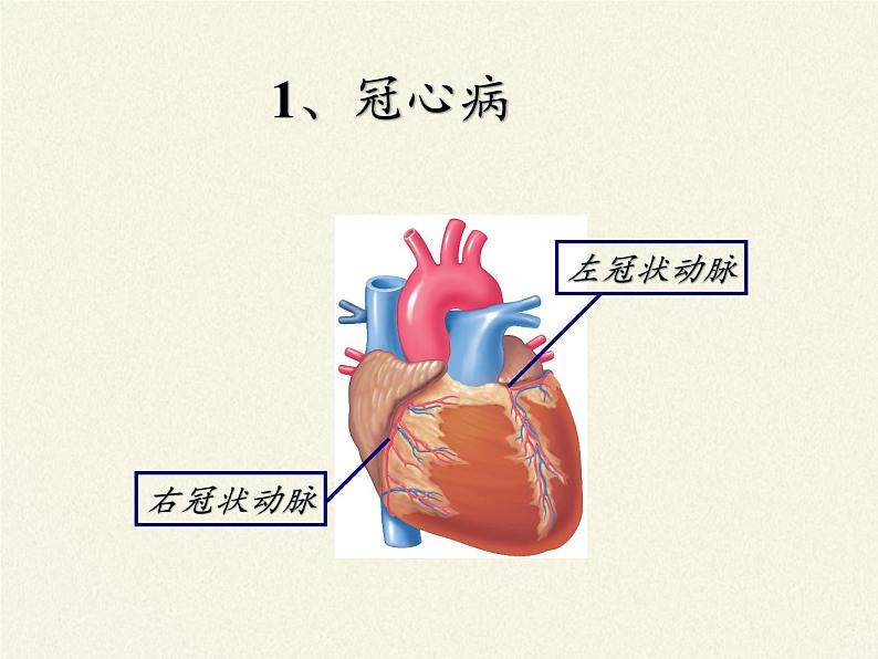 北师大版生物七年级下册 第13章 第4节 当代主要疾病和预防(课件)06