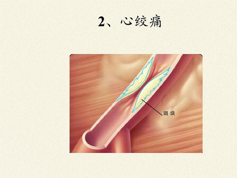北师大版生物七年级下册 第13章 第4节 当代主要疾病和预防(课件)08