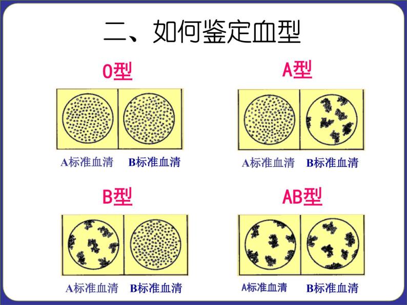 人教版七下生物  4.4输血与血型  课件08