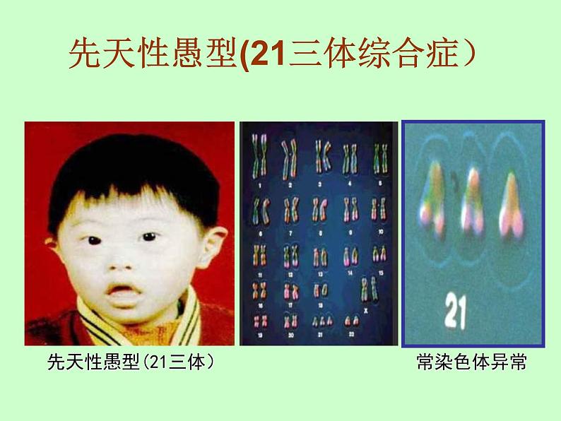 苏教版八年级下册生物 22.4遗传病和优生优育 课件第8页