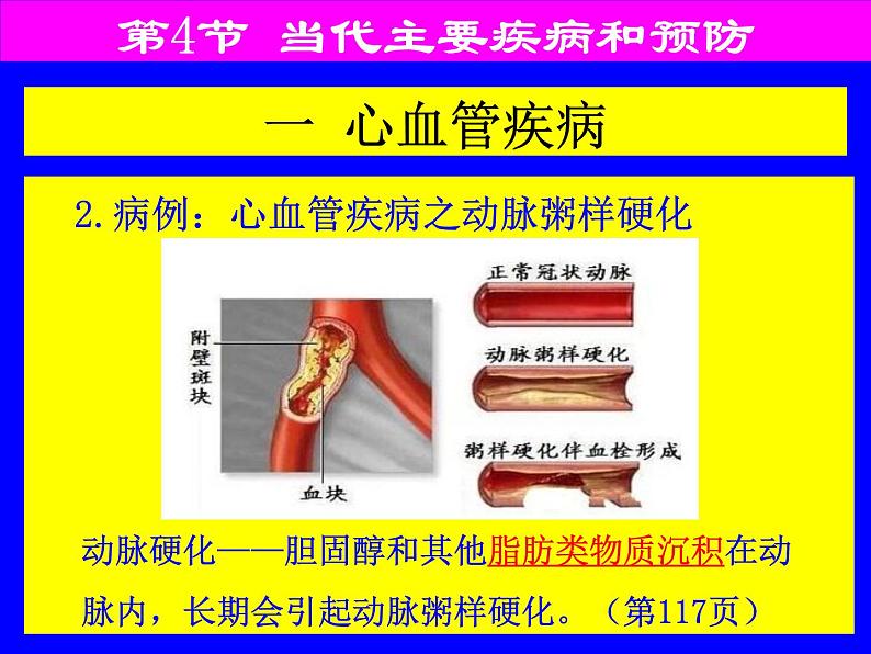 北师大版七下生物 13.4当代主要疾病和预防 课件第7页