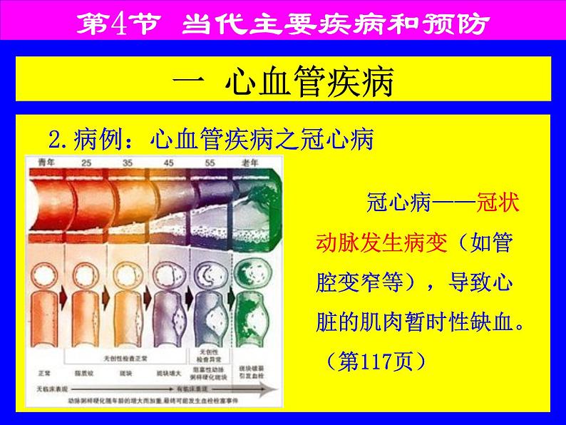 北师大版七下生物 13.4当代主要疾病和预防 课件第8页