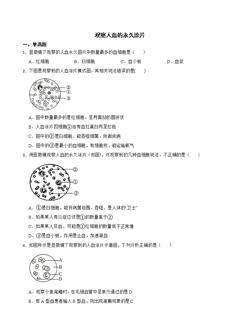 备考中考生物实验专项复习 察人血的永久涂片解析版第1页