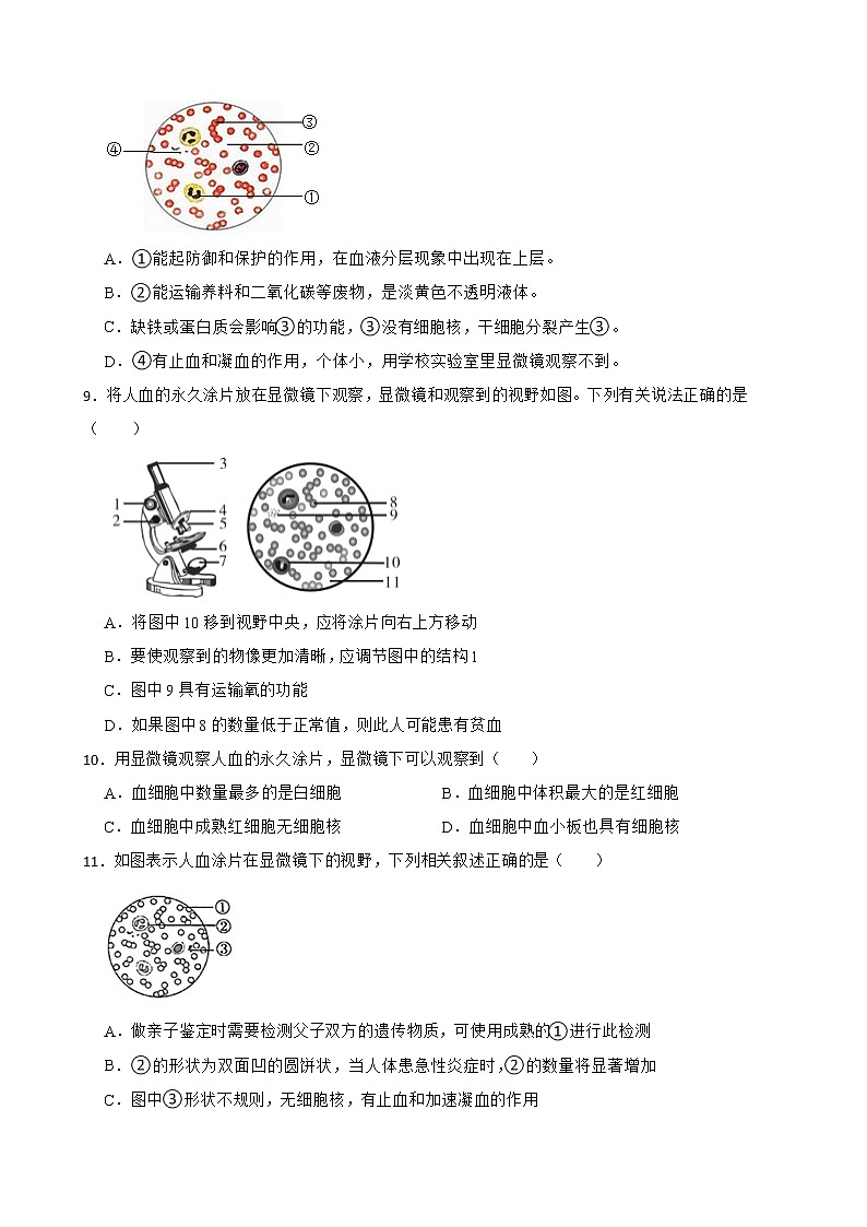 备考中考生物实验专项复习 察人血的永久涂片解析版第3页