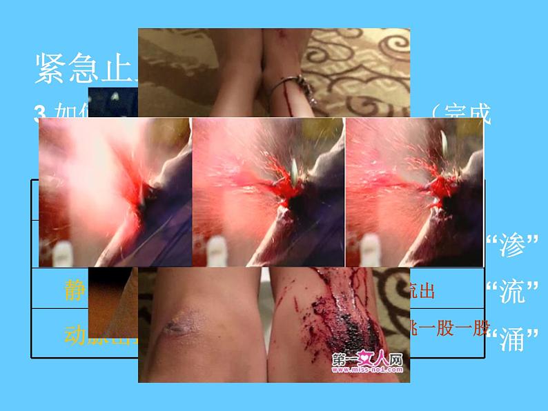 苏科版八年级下册生物 25.2关注家庭生活安全 课件07