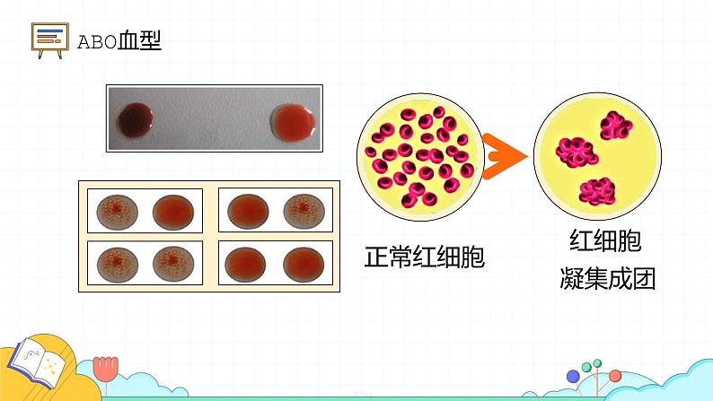 4.4.4 输血与血型(28张)-人教版生物七年级下册课件第7页