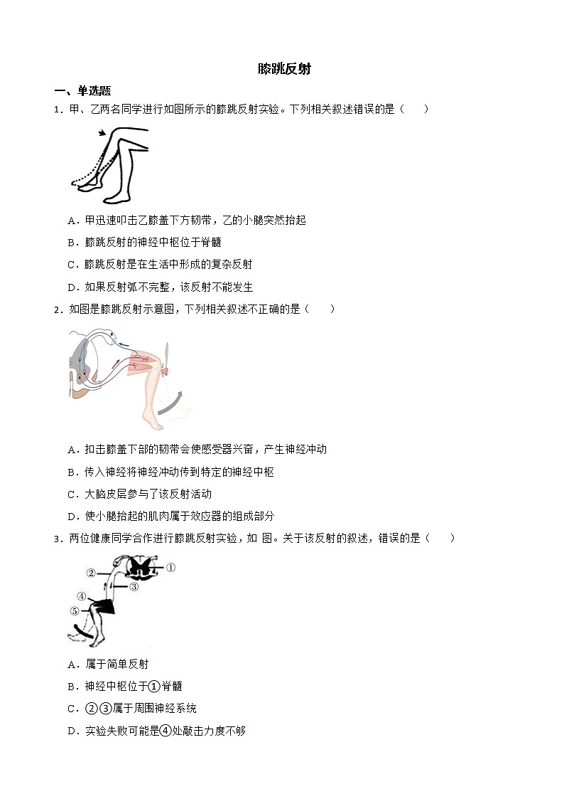 备考中考生物实验专项复习 膝跳反射解析版第1页