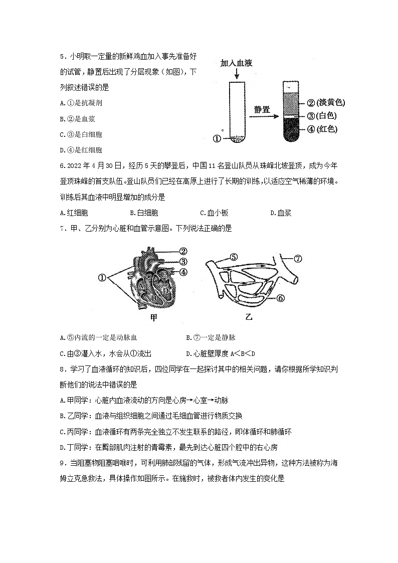 河南省平顶山市2021-2022学年七年级下学期期末考试生物试题(word版含答案)第2页
