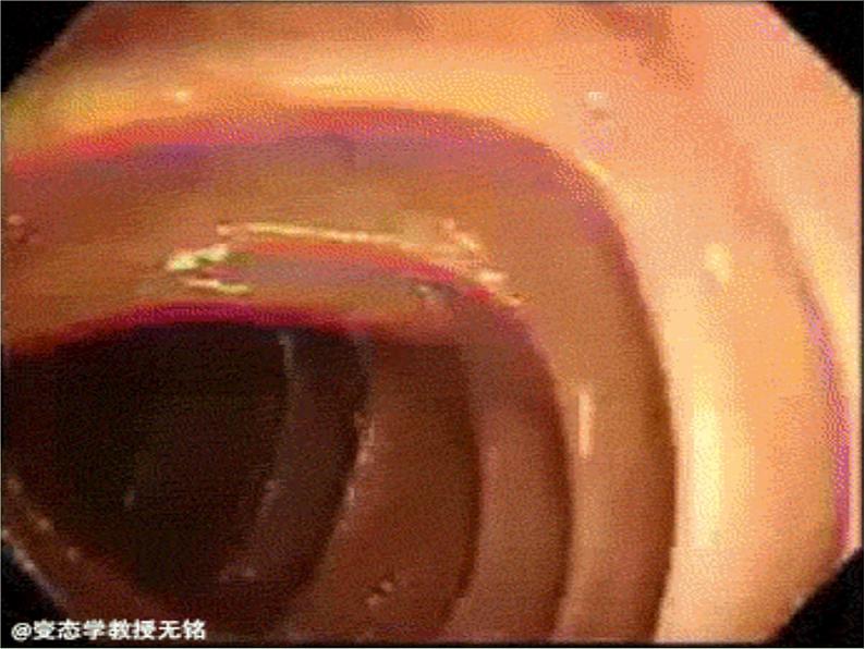 人教版八年级上册生物 5.1.2 线形动物和环节动物 课件第3页