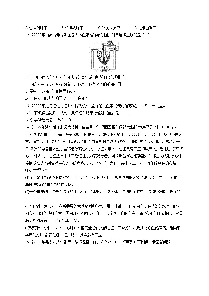 (7)人体内的物质循环——2022年中考生物真题专项汇编第3页