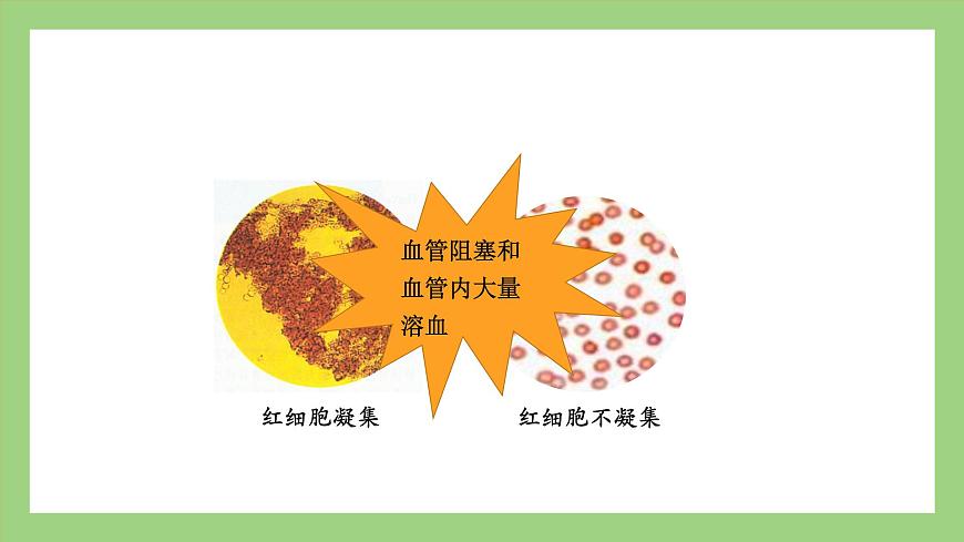 人教版七年級下冊生物 4.4.4輸血與血型(課件)第5頁
