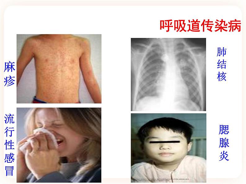 25.1传染病 课件03