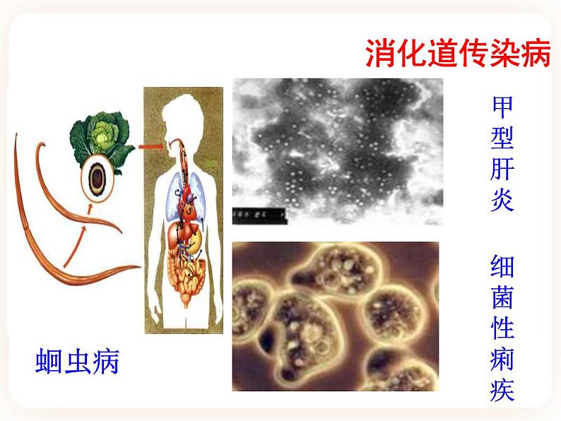 25.1传染病 课件04