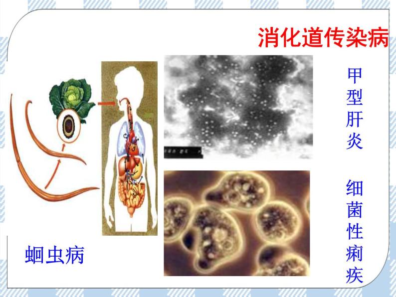 25.1传染病 课件04