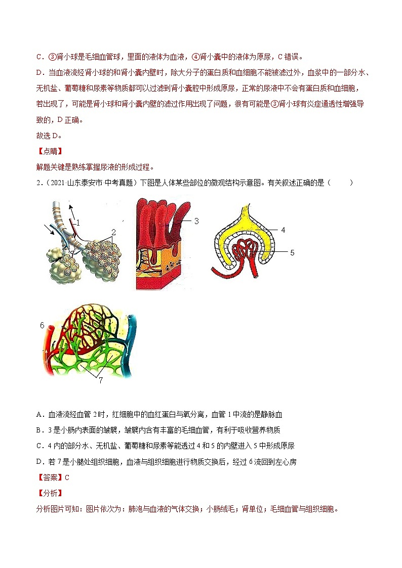 初中生物中考复习 专题06 人体内物质运输和废物排出-2021年中考生物真题分项汇编(全国通用)(第1期)(解析版)第2页