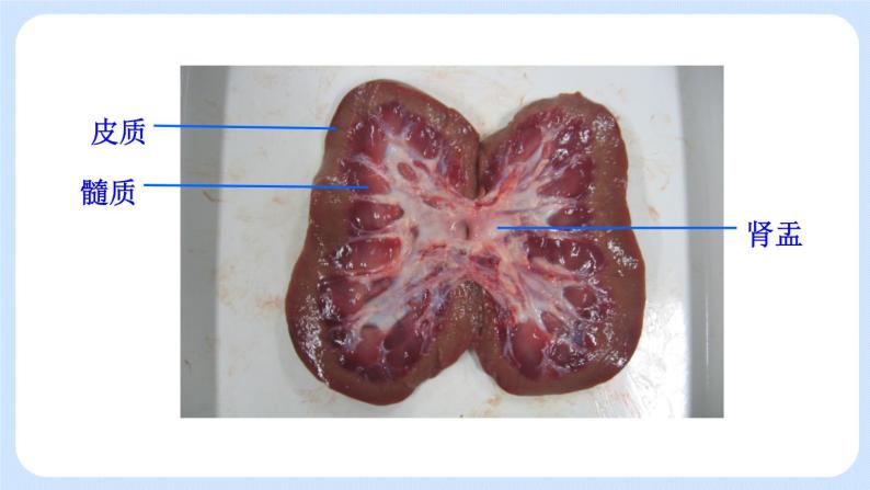 4.5.1《尿的形成和排出》(3)课件07
