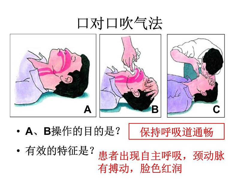 七年级下册_生物_急救常识_PPT课件 人教版初中生物课件ppt08