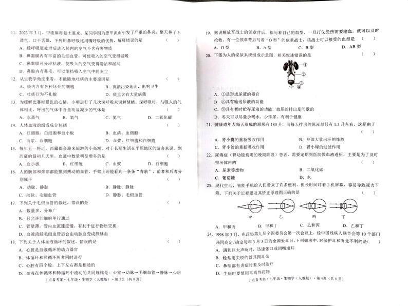 云南省石林县鹿阜中学七下5月月考生物卷02