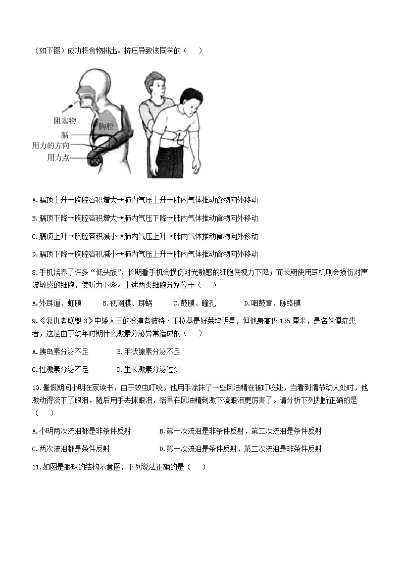 四川省巴中市2022-2023学年七年级下学期期末生物试题(含答案)第2页