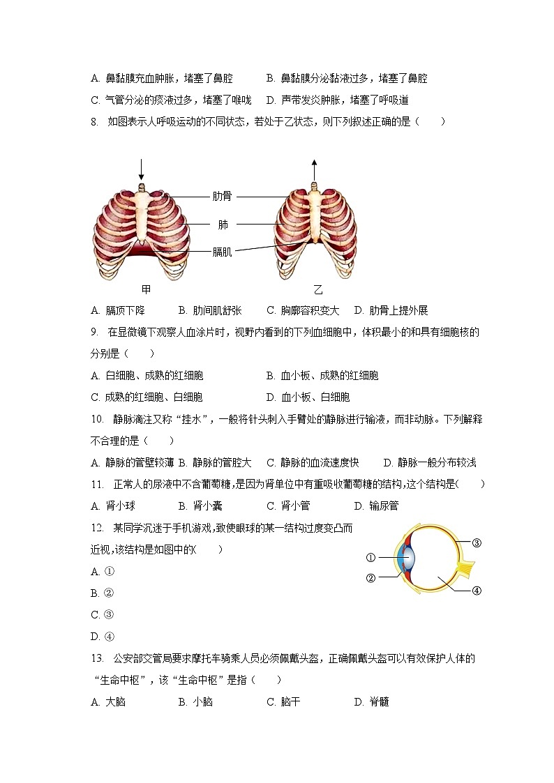 山西省吕梁市中阳县2022-2023学年七年级下学期期末生物试卷(含答案)02
