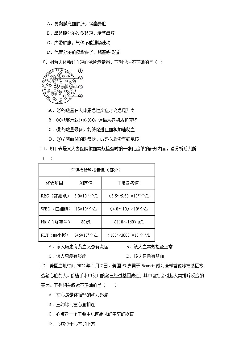 山西省临汾市洪洞县2022-2023学年七年级下学期期末生物试题(含答案)03