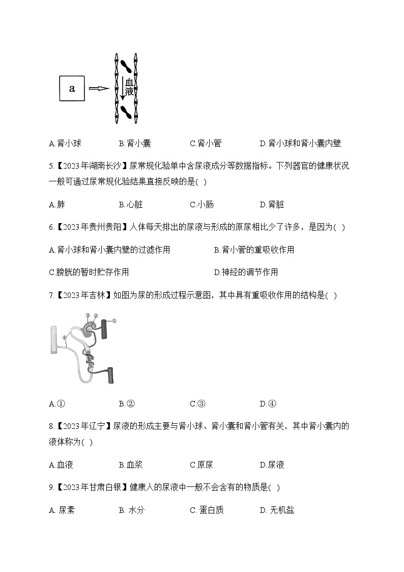 (8)人体的排泄——2023年中考生物真题专项汇编第2页