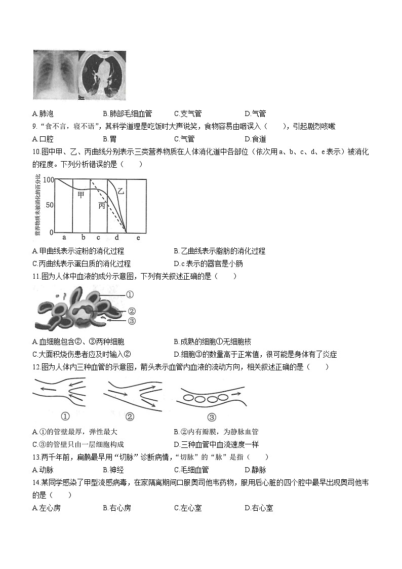 重庆市云阳县2022-2023学年七年级下学期期末生物试题02