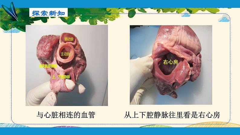 人教版生物七年级下册 第四章 人体内物质 的运输 第三节 输送血液的泵——心脏(案例一)第一课时-课件第8页