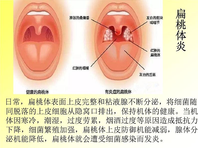 5.4.4 细菌和真菌在自然界中的作用(教学课件)人教版八年级生物上册第5页