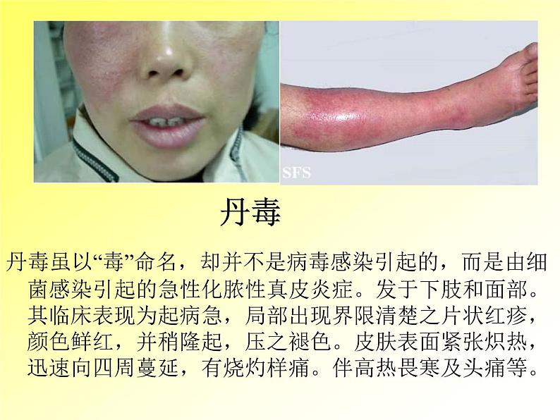 5.4.4 细菌和真菌在自然界中的作用(教学课件)人教版八年级生物上册第7页