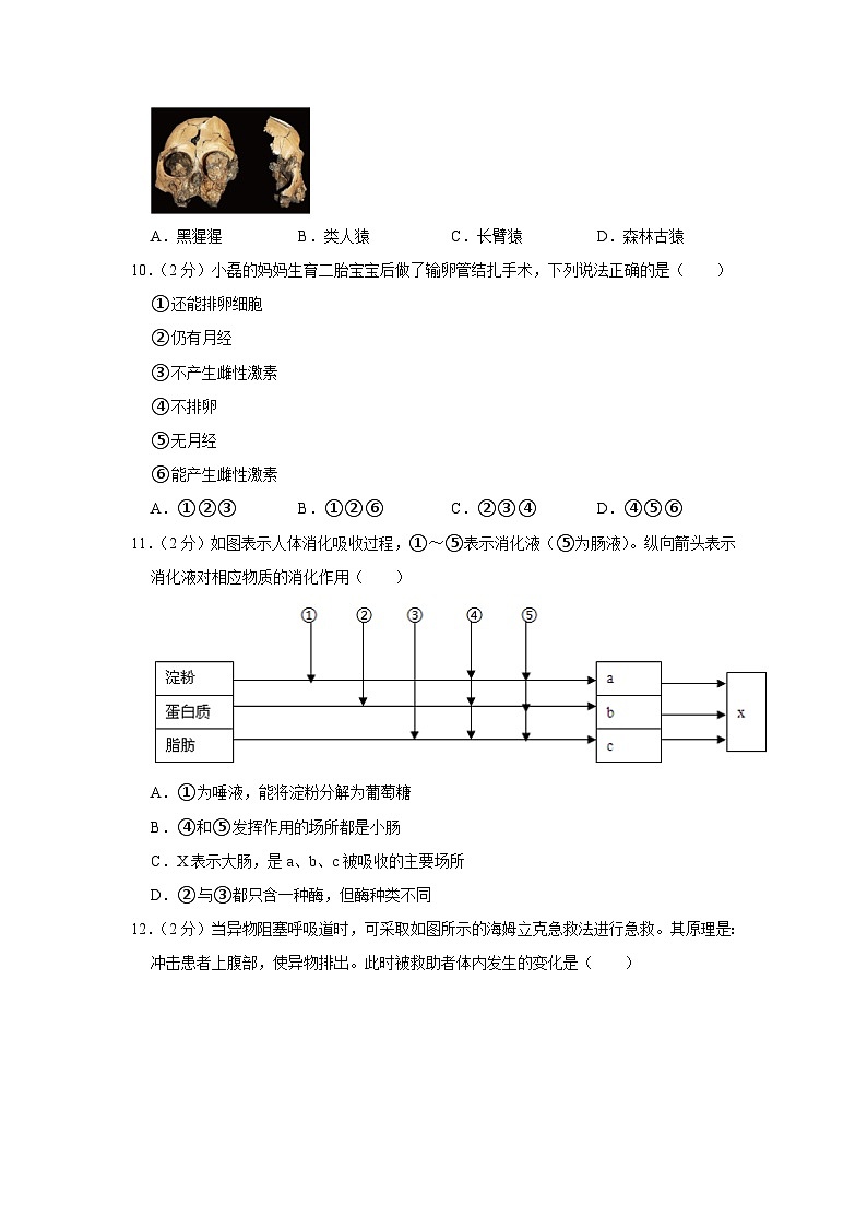 51,2023年云南省昆明十四中中考生物模拟试卷第3页