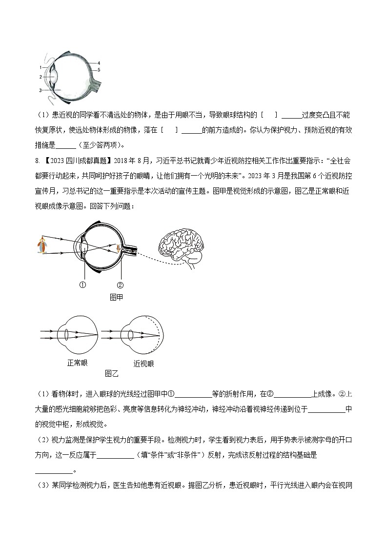 2024年中考生物真题分项汇编(全国通用)-专题11 人体生命活动的调节- 学易金卷:(第1期)(原卷版)第3页