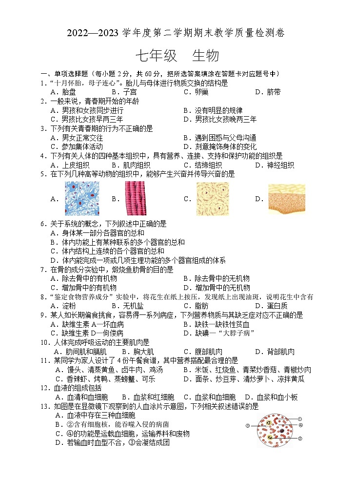 广东省肇庆地区2022-2023学年七年级下学期期末考试生物试题01