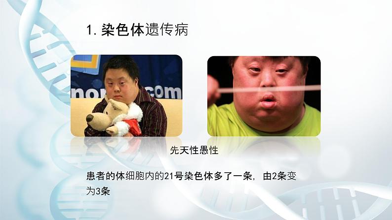 第五节 人类优生与基因组计划 课件教案07