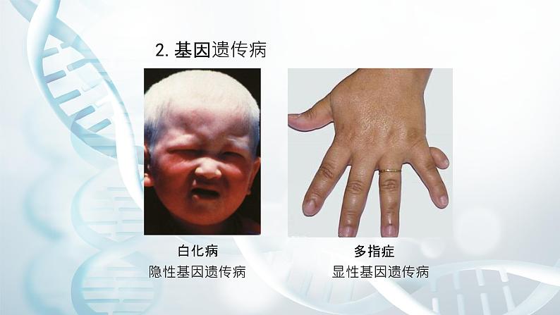 第五节 人类优生与基因组计划 课件教案08